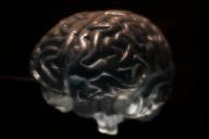 Крошечные органоиды мозга помогают ученым понять причины аутизма